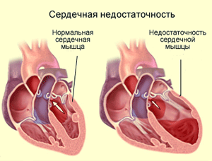 Можно ли выявить проблемы с сердцем по состоянию ног